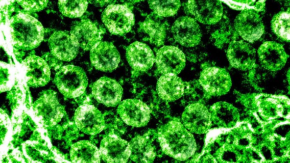 Illinois reports 4,162 more COVID cases, Region 2 to resume limited indoor dining