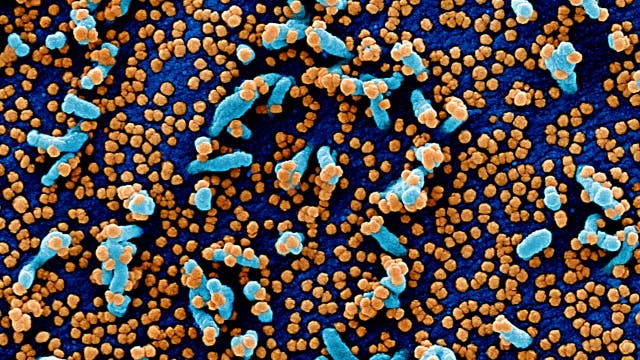 Illinois reports 2,120 coronavirus cases, 54 deaths in the last week