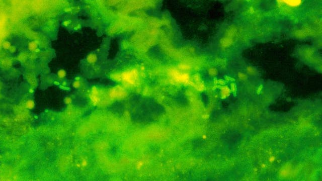 Illinois consumers potentially bought beef tainted with E. Coli bacteria: USDA