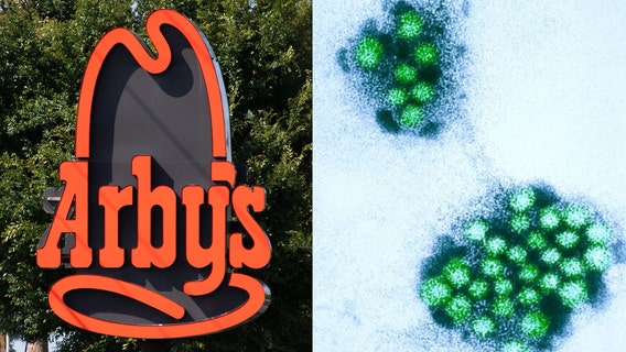 Illinois Arby's restaurant linked to nearly 100 norovirus cases