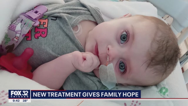 Illinois baby celebrating first birthday after breakthrough treatment at Lurie Children's Hospital