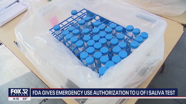 FDA issues emergency-use authorization for U of I COVID-19 test