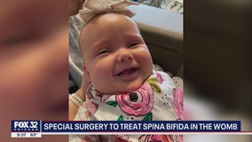 Chicago doctors performing special surgery to treat spina bifida in the womb