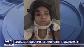 Chicago musician hospitalized with severe injuries after horrific crash in California