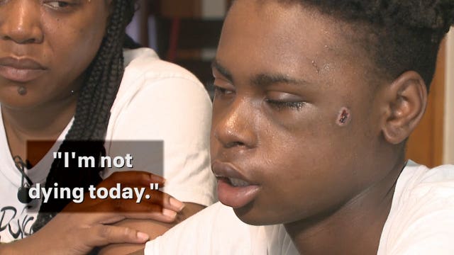 Milwaukee 15-year-old shot in the head has new outlook on life