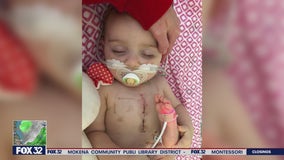 Crystal Lake father gets tattoo to match 4-year-old daughter's surgical scar