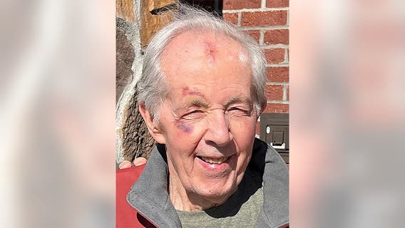 Marine veteran, blinded by his mask during gym workout, suffers bruising fall