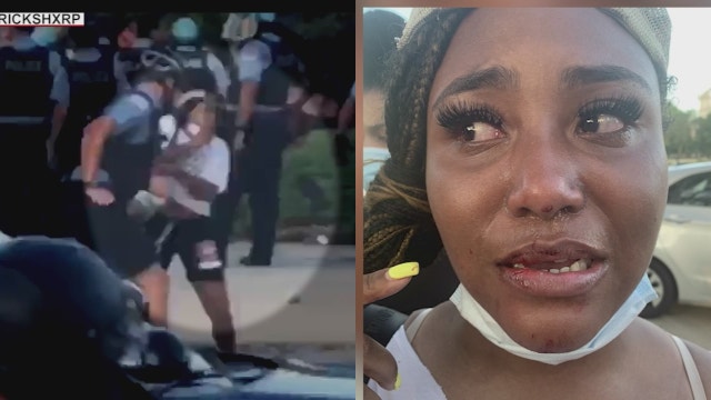 Chicago City Council OKs $280K settlement with activist struck by officer in 2020