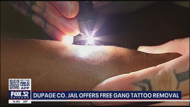 DuPage County Jail program offers free tattoo removal to inmates wanting to escape gang lives