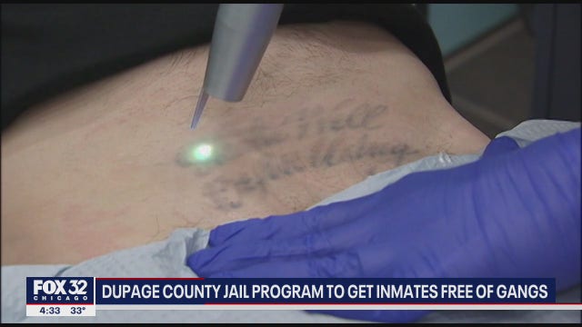 DuPage County Jail offering free tattoo removal services