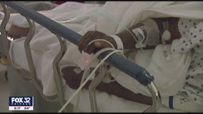 Scientists find room for improvement in colonoscopies