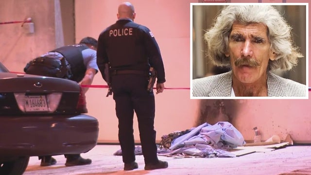 Chicago's 'Walking Man' now listed in fair condition after suffering severe burns in attack last month