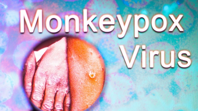 Illinois declares monkeypox a public health emergency — what to know