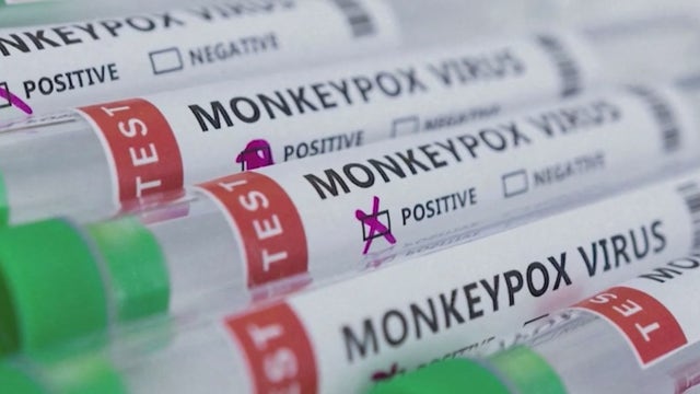 US declares monkeypox a public health emergency — what that means for Chicago