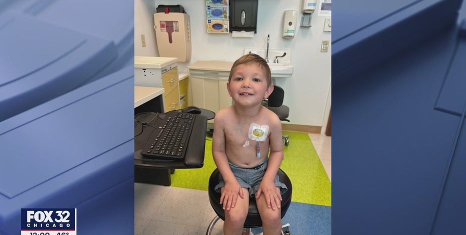 Lisle boy battling cancer who received thousands of birthday cards now 'doing much better'