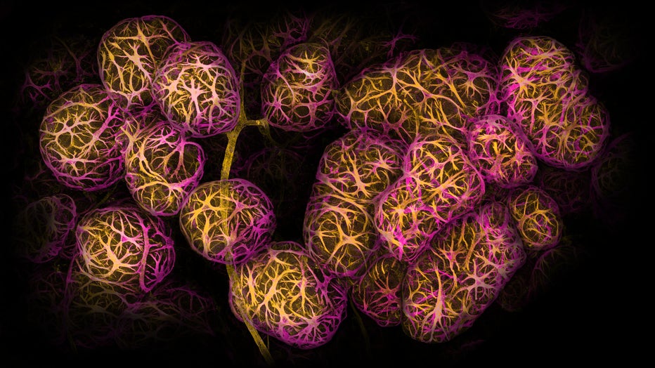 2-Dawson_breast_alveoli_in_lactation.jpg