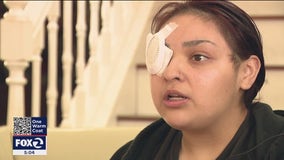Antioch fast-food manager speaks out after losing eye while defending teen with special needs