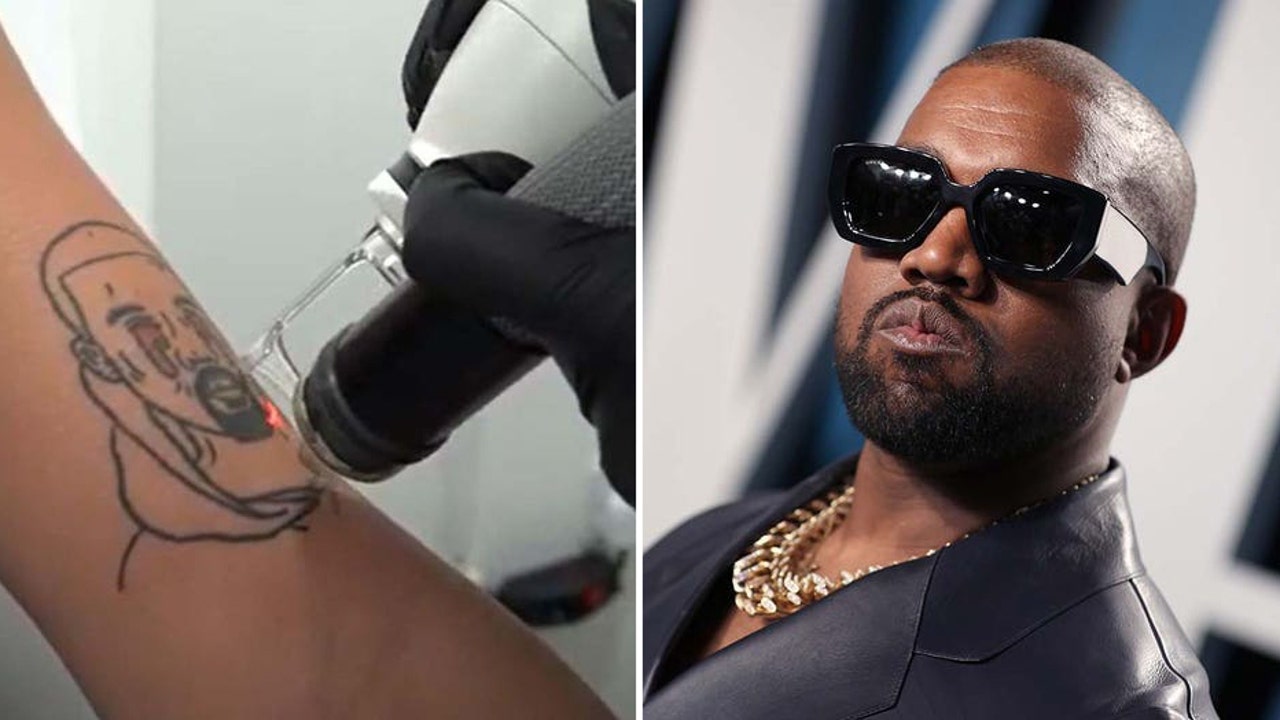 Kanye West former fans have tattoos removed