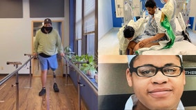Dakotah Earley: Video shows Lincoln Park shooting victim using new prosthetic leg