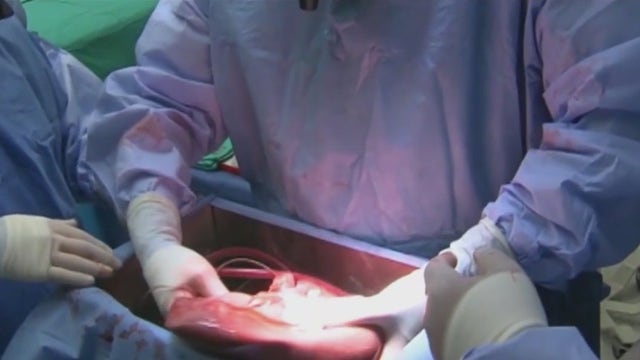 Illinois Organ and Tissue Donor registry reaches 7.5M participants