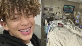 TikTok 'Flamethrower' challenge puts teen in hospital with burns to over 70% of his body