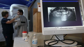 AI game-changer makes leaps toward future by detecting dental diseases earlier than ever: 'Cutting edge'