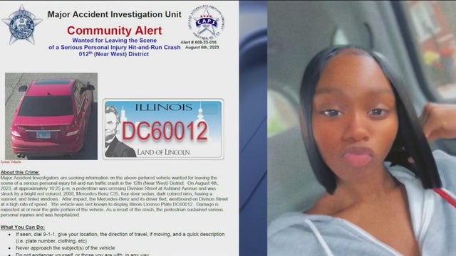 High schooler fighting for her life after vehicle struck her, dragged her in Noble Square, family says