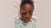 Family calls for justice after 11-year-old Chicago girl brutally beaten in Lawndale