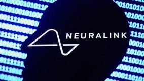 Elon Musk says first human patient will soon receive Neuralink brain implant