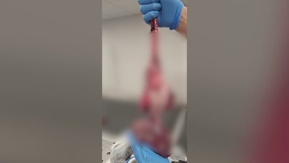 Customs and Border Protection makes bizarre discovery at O'Hare