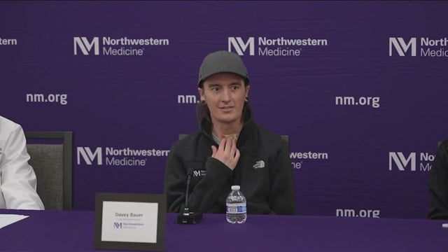 Chicago doctors use breast implants to perform successful double-lung transplant