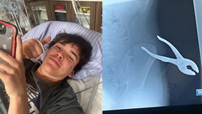 Pliers impale Kansas teen after he slips on ice while shoveling snow: 'I didn't know they were in there'