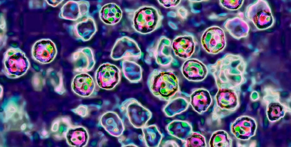 Chicago measles cases decline following vaccination efforts