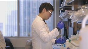 Northwestern Medicine discovers possible lupus cure