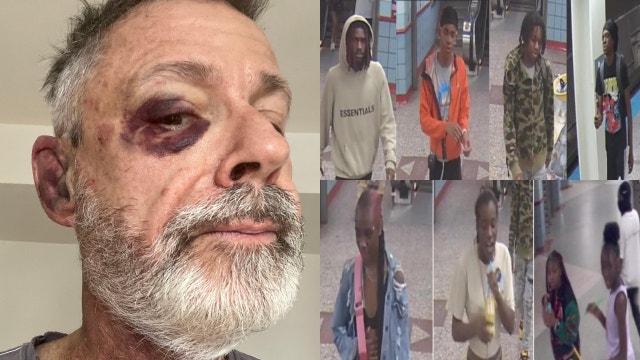 Teenager faces charges after group attacked, robbed 63-year-old man on CTA train