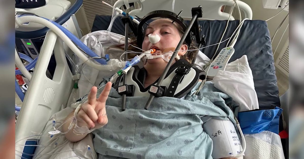 Chicago-area woman's mystery pain linked to rare disorder, doctors