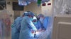 Northwestern surgeons perform first-of-its-kind split liver transplant in US