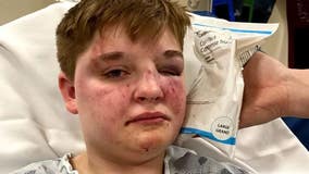 Felony charges filed after fight sparked by derogatory remarks at suburban McDonald's: police