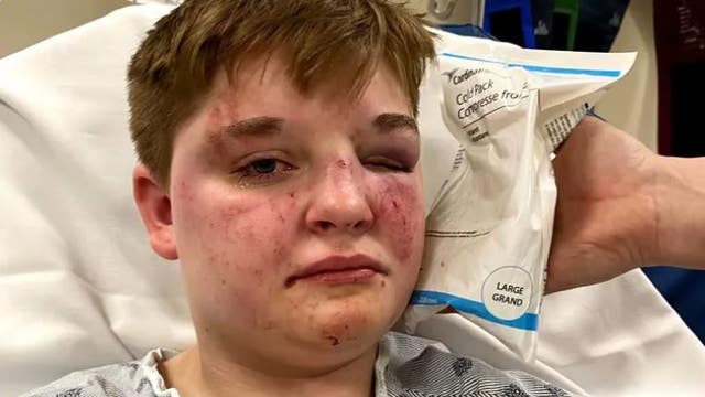 Felony charges filed after fight sparked by derogatory remarks at suburban McDonald's: police