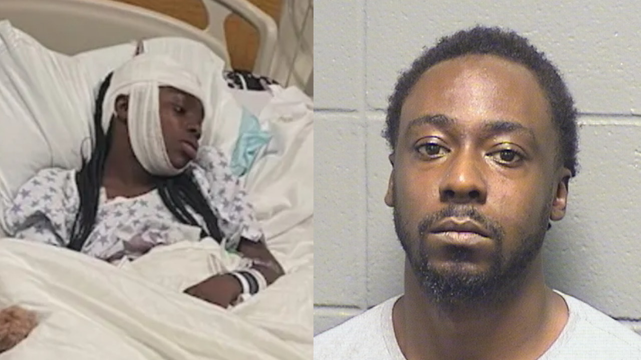 Harvey Man Charged Shooting 11-Year-Old Girl
