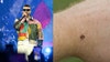 Justin Timberlake has Lyme disease — Here’s why it’s commonly misdiagnosed, according to an expert
