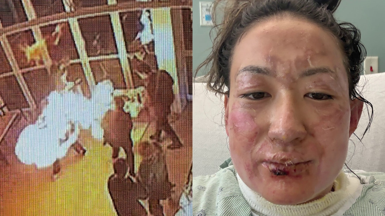 Lawsuits Allege Negligence After Fire Injuries at Chicago Navy Pier Restaurant