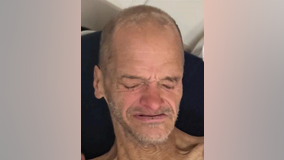 Chicago police seek help identifying man found in Portage Park