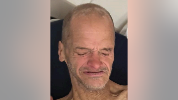Chicago police seek help identifying man found in Portage Park
