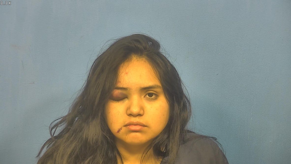 Chicago woman caused DUI crash that severely injured 10-year-old boy: prosecutors