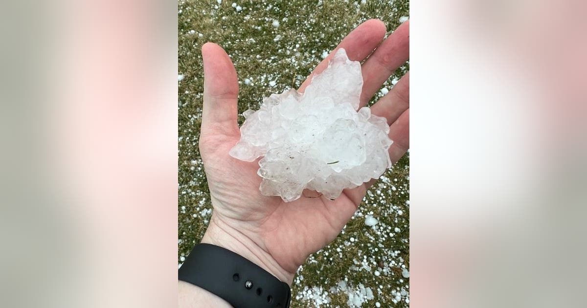 Chicago weather: Photos show baseball-sized hail as severe storms sweep through Chicago area