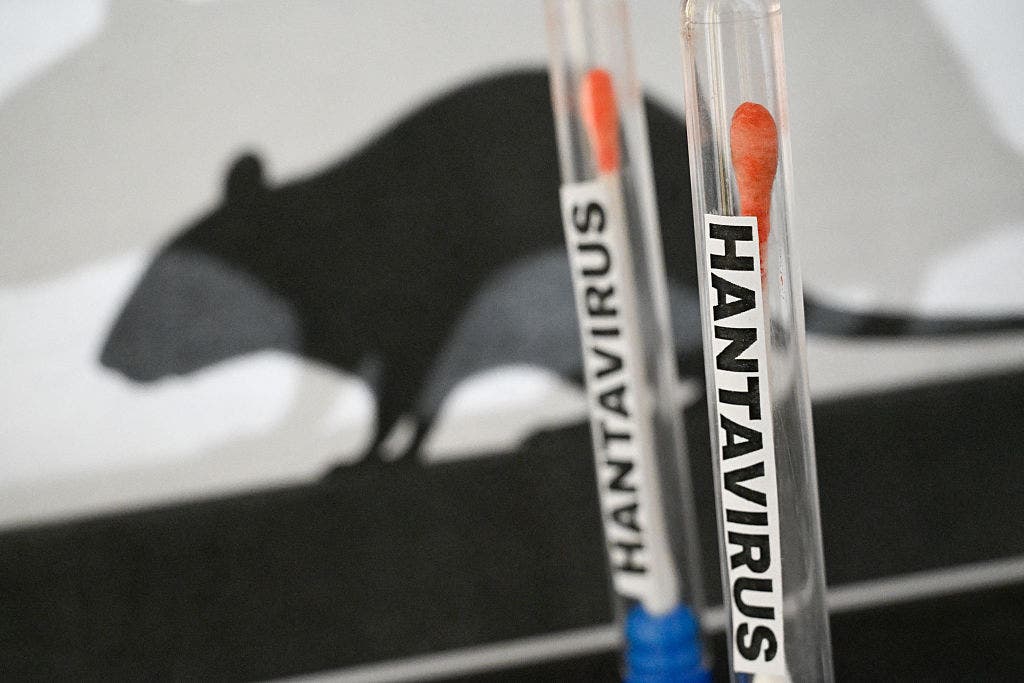 Suspected hantavirus case in Illinois tests negative, health officials say