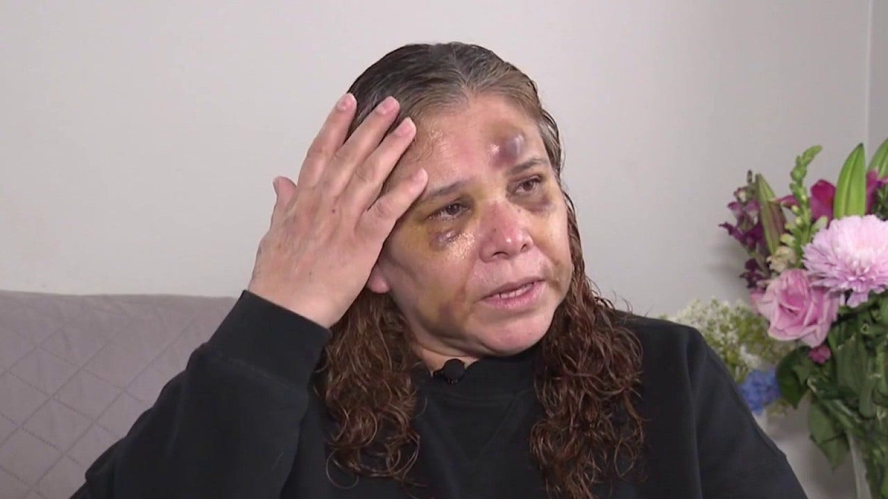 Chicago mom beaten during armed robbery linked to shooting of CPD officers speaks out
