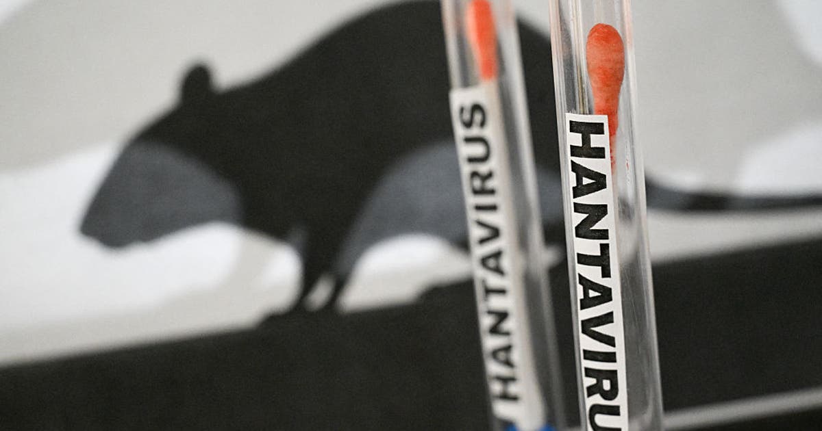 Suspected hantavirus case in Illinois tests negative, health officials say