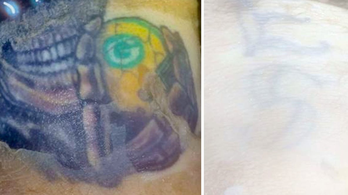 Severed arm with Green Bay Packers tattoo found in Illinois lake belonged to Plainfield man, police say